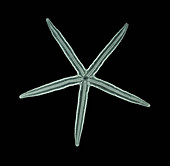 'Starfish,X-ray'