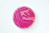 Petri Dish of Acinetobacter Baumannii