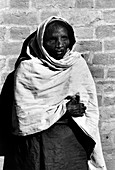 Woman with leprosy
