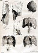 18th Century Anatomical Engraving
