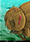 SEM of a Mutant Fruit Fly