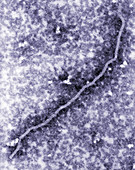 Nipah virus