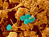 'Human Platelets & Staphylococcus,SEM'