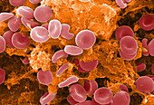 SEM of Red Blood Cells