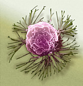 'Breast Cancer Cell,SEM'