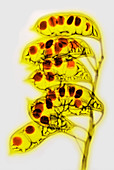 Colorized X-ray of Seed Pods