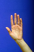 Female Hand and Wrist