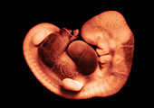 35 day old human embryo