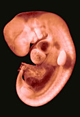 30 day old human embryo