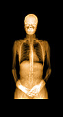 Human Body X-ray and CT