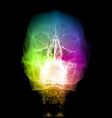 'Skull,X-Ray'