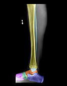 Lower Leg Anatomy