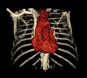 3D CT Reconstruction of Heart