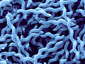 Campylobacter Jejuni