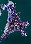 SEM of Pinocytotic 3T3 Cell