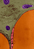 TEM of Rat Adipose Cells