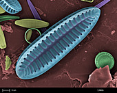 'Freshwater Diatom,SEM'