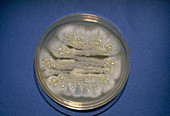 Exudate of Penicillium Mold