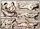 Aztecs Dying of Smallpox