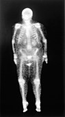 Nuclear scintigraphy
