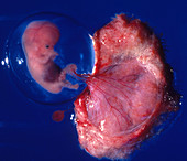 Embryo and Placenta - Two Months