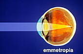 Emmetropia Diagram
