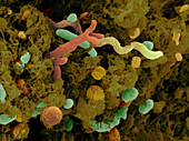 SEM of Cow Feces Bacteria