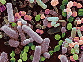 Urine Contaminated by Bacteria SEM