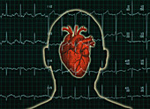 EKG and Heart over head