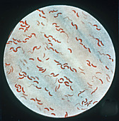 Vibrio cholerae