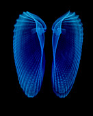 Clam Shells X-Ray