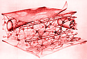 Microtrabecular Lattice