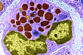 Basophilic Leucocyte