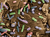 Bacteria in Dog Feces,SEM