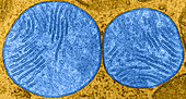 Stages of Mitochondrial Division,TEM