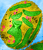 Euglena Chloroplasts (TEM)