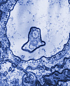 Lepoclis Flagellum (TEM)