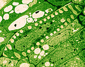 Differentiating Xylem in Bean Plant (TEM)