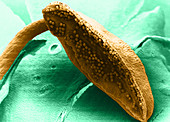 Open Anther With Pollen Grains (SEM)