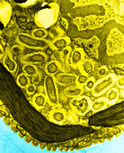 Cytoplasmic Bacteria (TEM)