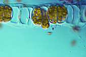 Ulothrix sp. Algae (LM)