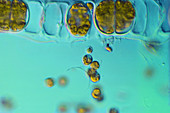 Ulothrix sp. Algae (LM)