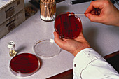 Antibiotic Sensitivity Test