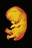 Human fetus