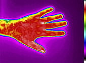 Thermogram of a Man's Hand
