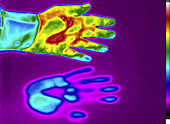 Thermogram of a thermal shadow