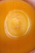 Chick Embryo,24 Hrs