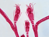 LM of Obelia Hydrozoa Polyps