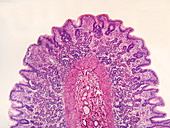 LM of Stomach