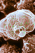 HIV-1 Infected T4 Lymphocyte (SEM)